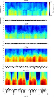 Neurophysiology of Avian Sleep: Comparing Natural Sleep and Isoflurane Anesthesia